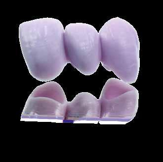per restauri di denti singoli, trattamenti con abutment ibridi e ponti di 3 elementi** Corone con uno spessore di