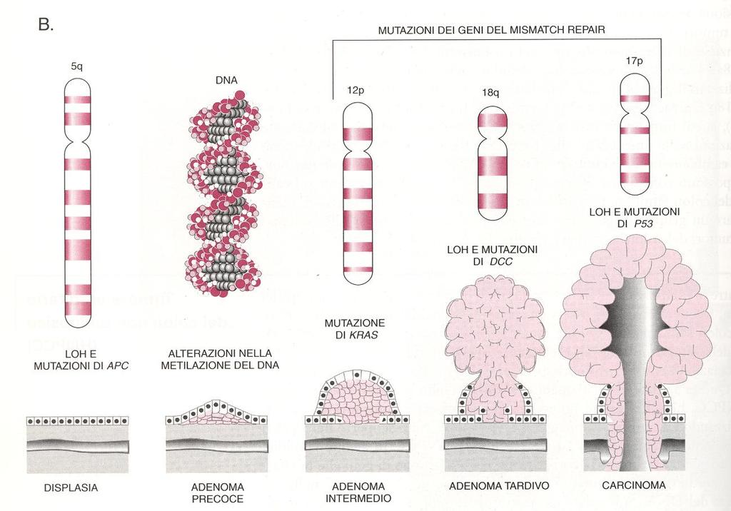 Il modello di Fearon e Vogelstein per lo sviluppo del carcinoma