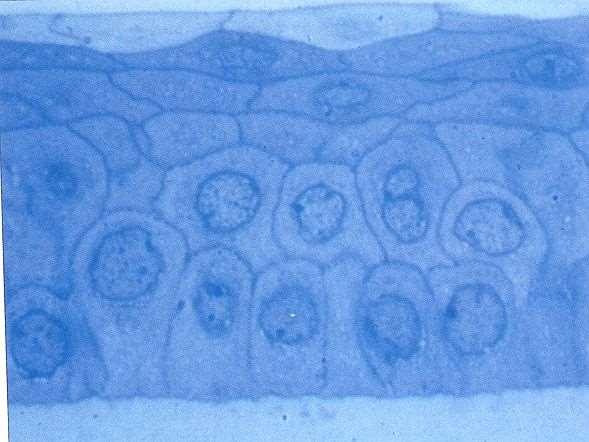 CORNEA: epitelio Pavimentoso composto cellule basali:cilindriche, desmosomi e tight-junction 2-3