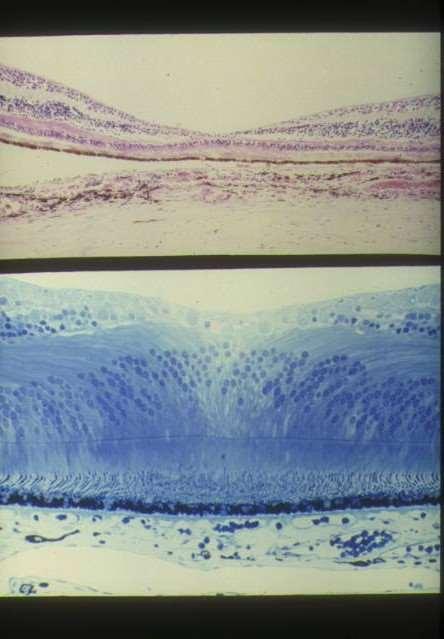 Retina: macula 4 strati: Epitelio pigmentato Fotorecettori Membrana