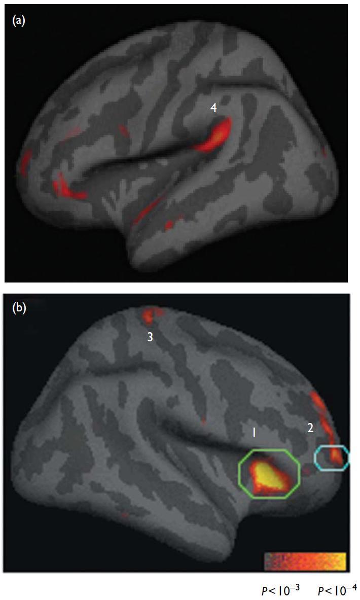 INSULA auditory cortex visual cortex BA 9/10