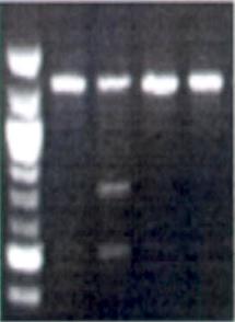 SNPs La sostituzione di una base puo provocare la perdita o l insorgenza di un sito di restrizione, utilizzando PCR e digestione dell amplificato si puo rapidamente evidenziare l avvenuto cambiamento