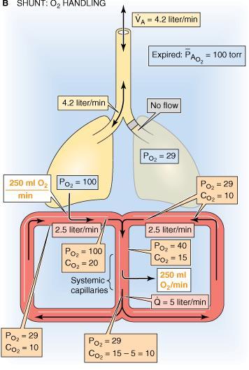 Shunt Quando lo shunt è causato dall aggiunta di sangue venoso misto è possibile calcolare il flusso di sangue attraverso lo shunt Quando lo shunt è causato dall aggiunta di sangue che non ha