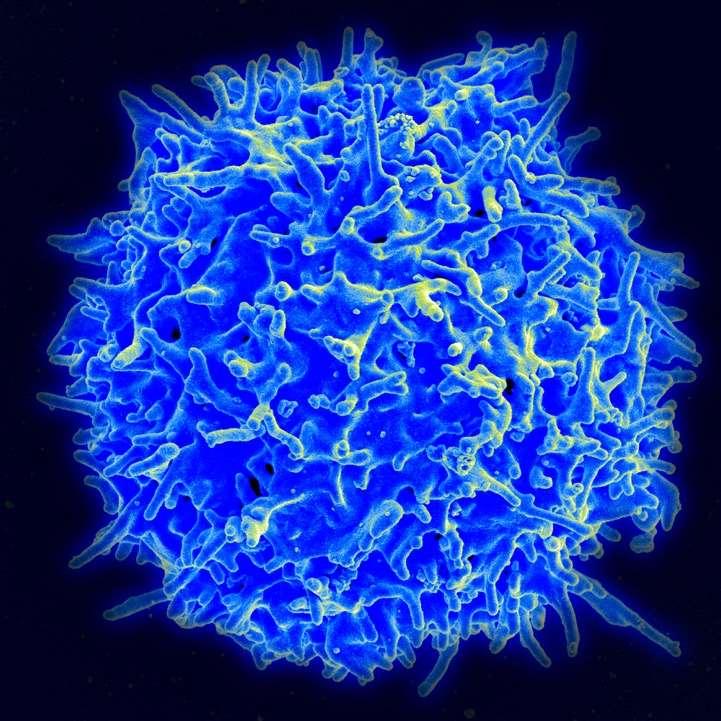 Recentemente un ampio numero di linee cellulari di tipo B in tessuti gengivali sono stati osservati presentare un fenotipo che può fortemente stimolare T- cell autoreattive, aventi la capacità di