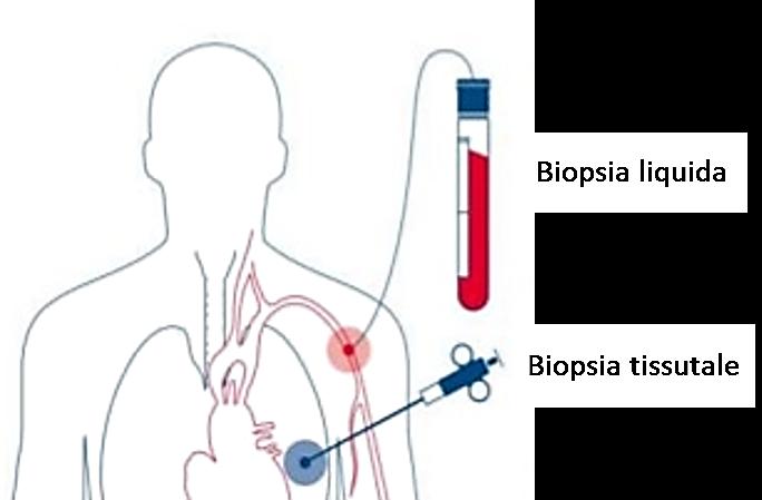 Cosa si intende per biopsia liquida?