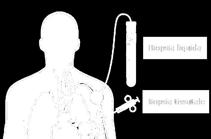 (generalmente si tratta di un prelievo di sangue). (Figure 2 e 3). Il termine biopsia liquida è una definizione impropria che spesso ingenera malintesi.