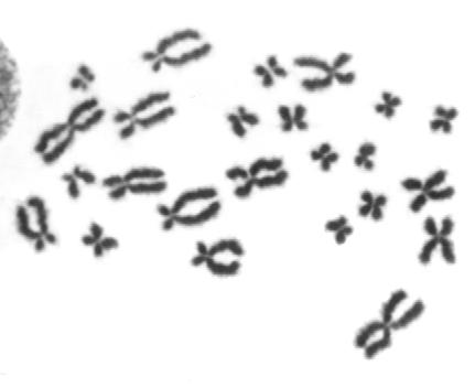 al diploide) e.g. TRIPLOIDIA ANEUPLOIDIE > aberrazioni numeriche dovute a non-disgiunzione meiotica o post-zigotica.