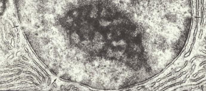 le grandi molecole RNA, proteine involucro nucleare nucleoplasma