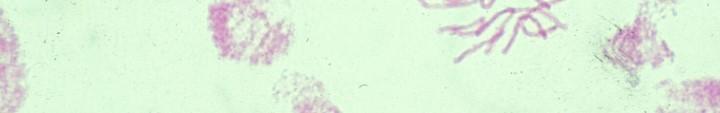 Colorazione Feulgen cromosoma centromero cromatidio