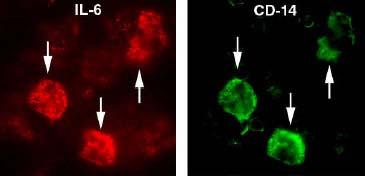 Le due immagini sono dello stesso campo in due condizioni diverse di illuminazione.