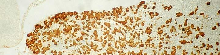 interazione antigene-anticorpo E = enzima