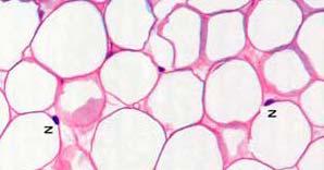 Strutture acidofile: componenti del tessuto che hanno affinità per i coloranti