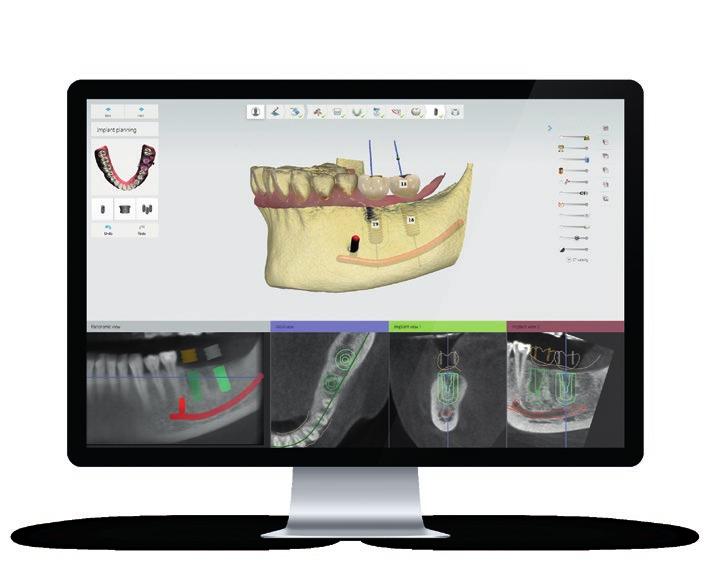 costante crescita, aggiornamenti continui del software e l opzione