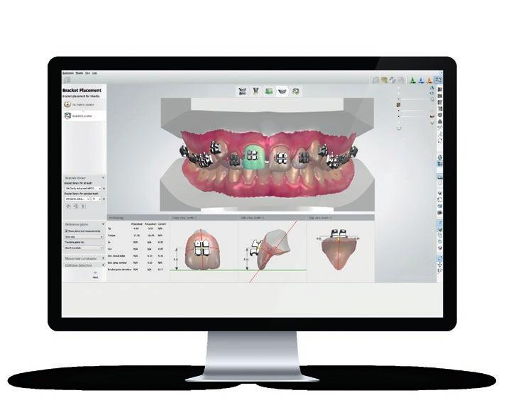 3Shape TRIOS Design Studio Fornite l odontoiatria immediata