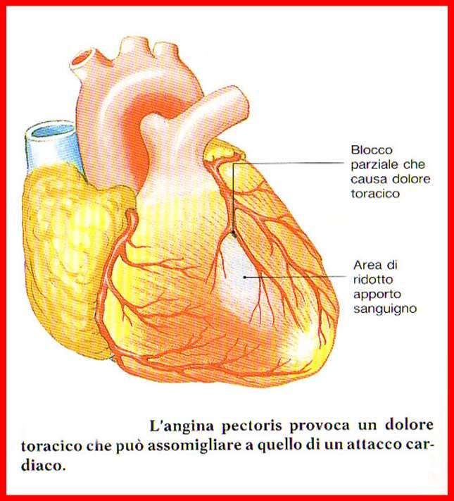 ANGINA