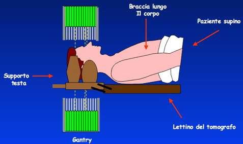*Aspetti Tecnici-Metodici cerebrale Posizionamento paziente MET * Posizione supina sul lettino. * Braccia lungo il corpo.