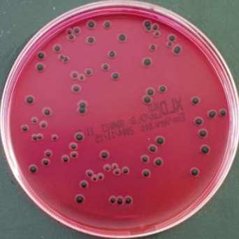 Caratterizzazione isolati batterici