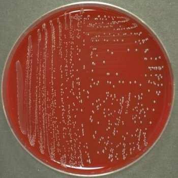 Gram-positivi Staphylococcus aureus Enterococcus faecalis - Enterococcus faecium Fenotipi da monitorare: