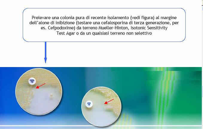 È preferibile effettuare un test di