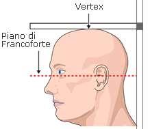 orizzontale la linea di visione (piano di Francoforte) Piano ideale che congiunge il Porion