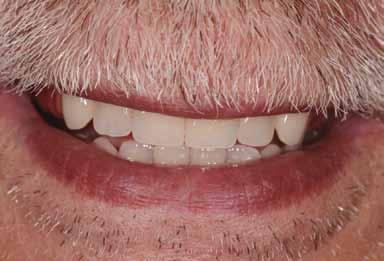 98 e 99) e la posizione dei denti valutando: il parallelismo degli incisivi superiori con la linea bipupillare; la positività della linea del sorriso; il giusto allineamento della