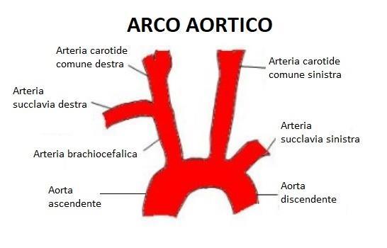 ANOMALIE DELL ARCO AORTICO DEFINIZIONE Si tratta di una varietà di anomalie congenite riguardanti la posizione e la ramificazione dei vasi dell arco aortico ovvero la struttura vascolare che connette
