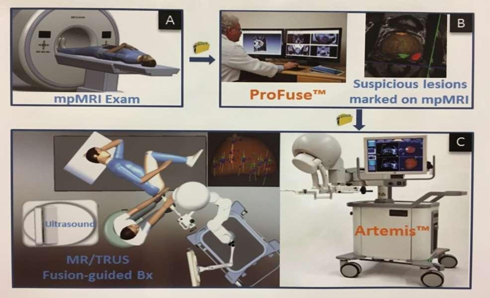 MR TRUS fusion-guided biopsy 6 MR è sempre più frequentemente applicata per lo studio del tumore