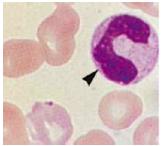 facilmente evidenziabile in una cellula