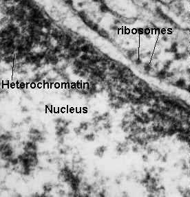 05_nucleo Membrana esterna cisterna perinucleare 7nm 15-40 nm