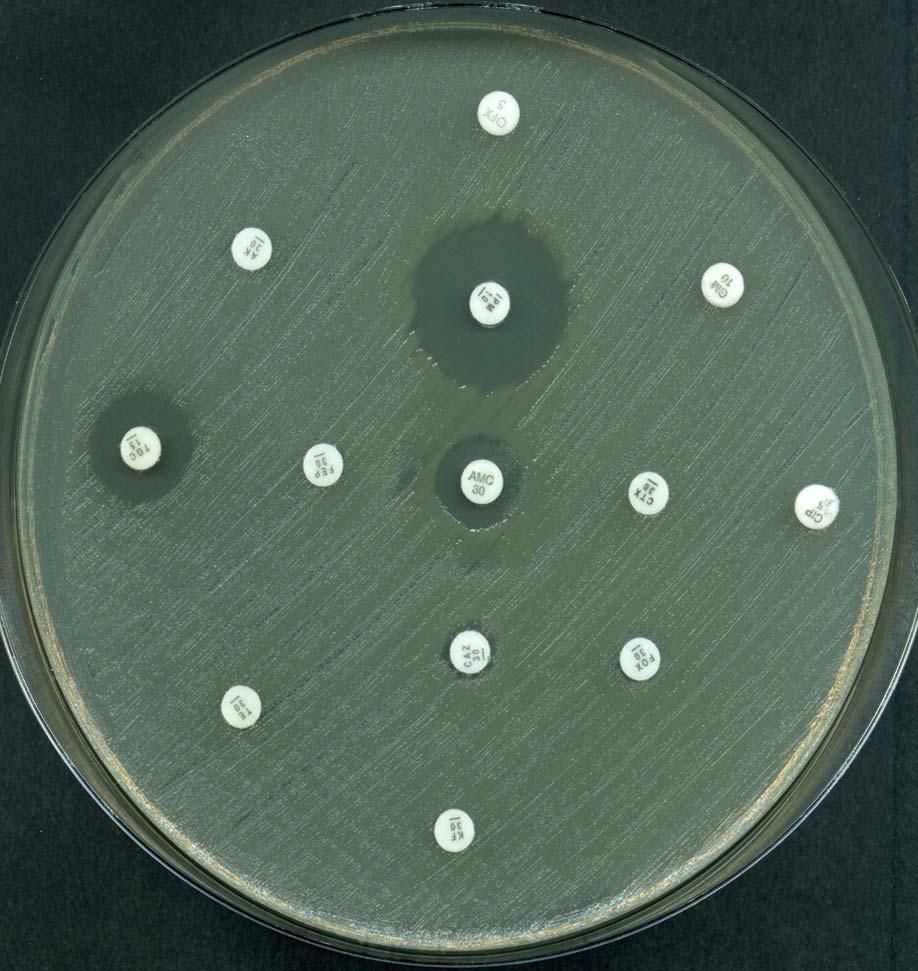 Il gene originale è stato scoperto sul cromosoma delle specie di Kluyvera CTXM MDR K.