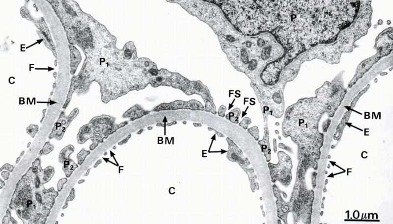 Membrana Basale Separa i podociti e l endotelio