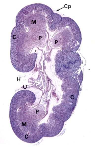 Anatomia Capsula Fibrosa e sottile Corticale Più scura, presenza di strutture circolari Midollare Più chiara, struttura