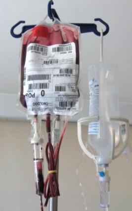 Prevenzione dell infezione da HIV Via parenterale (trasfusioni ed emoderivati): ütrasfusione