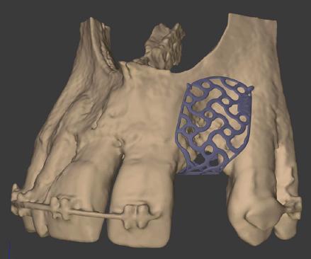 che, tramite un attenta analisi tridimensionale, consentono di personalizzare le procedure