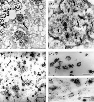 Placenta-derived Exosomes and Syncytiotrophoblast Microparticles