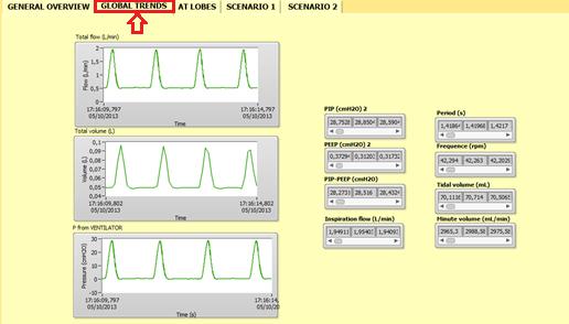 A.3 Funzionamento globale del sistema STEP 3 Come prima, dopo aver preso i valori di offset e di resistenza, vediamo il funzionamento del sistema globale. A.3.1 Funzionamento senza i motori Cannula inserita nel circuito respiratorio del sistema Monitor ventilatore acceso Alimentazione dei motori spenta Cliccare il tasto PLAY Cliccare sul pulsante RUN.