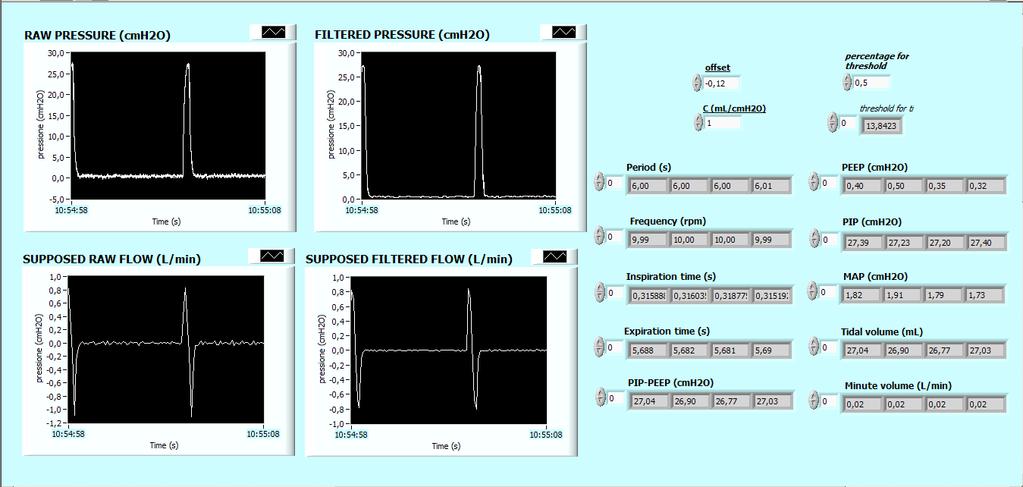 a. b. Figura 3.10: Esempi di GUI con simulazione di ventilazione assistita in differenti modalità: a. AC ciclata flusso, b. SIMV/IMV. positivo.
