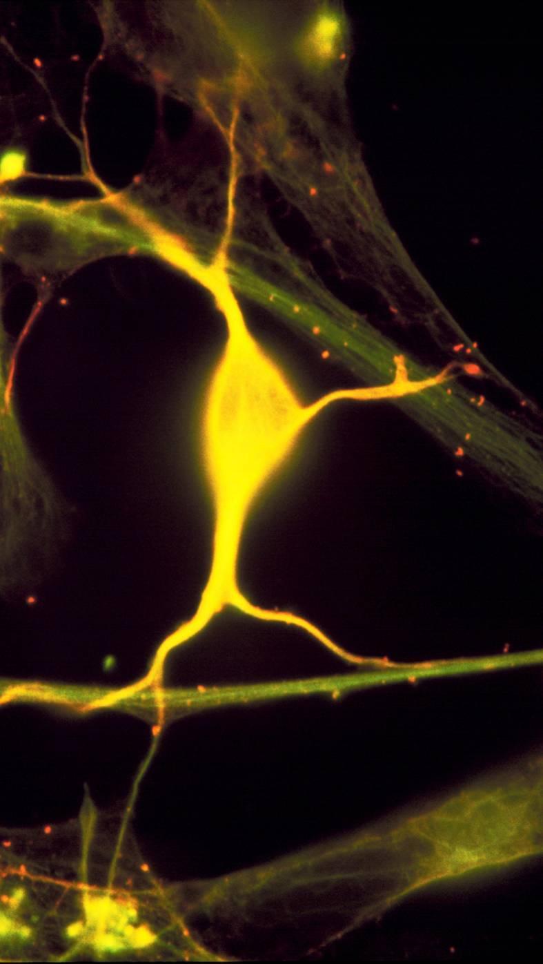 Neurogenesi La neurogenesi è la nascita di nuove cellule neuronali.