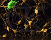 Morte neuronale Vengono prodotti circa il 50% in più dei neuroni necessari. La morte neuronale programmata (apoptosi) è quindi normale.