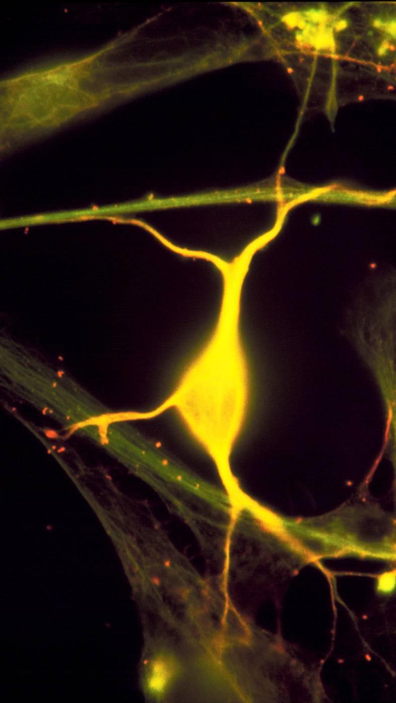 Le condizioni che permettono la sopravvivenza e lo sviluppo neuronale sono: Neurotrofine che promuovono la crescita, lo sviluppo e la sopravvivenza guidando gli assoni e stimolando la sinaptogenesi