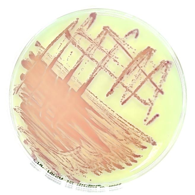 methicillin-resistant Staphylococcus aureus.