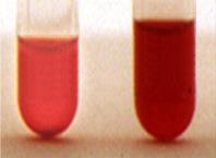 Il trattamento con eculizumab in EPN blocca l emolisi intravascolare e i sintomi correlati abroga o riduce il fabbisogno trasfusionale riduce il rischio trombotico è sicuro, nonostante il rischio di