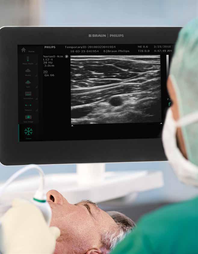 Xperius TM Ultrasound System