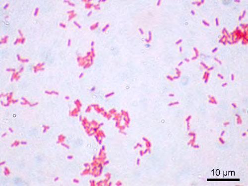 Escherichia coli e Enterococchi intestinali.