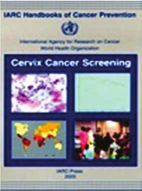 Liquid Based Cytology The Global Situation In the United States at least 80% percent of all Pap tests are LBC LBC is widely used in Europe.