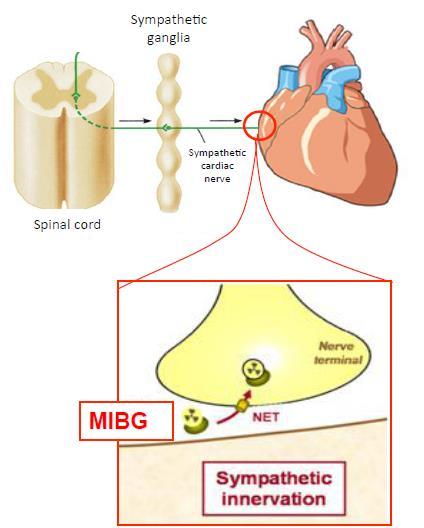 Scintigrafia miocardica con MIBG Studia innervazione
