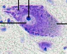 Corpo cellulare o soma Morfologia variabile: Stellata (motoneuroni) Piramidale (corteccia cerebrale) Piriforme (Pukinje del cervelletto) Sferica (gangli sensitivi) Nucleo: Voluminoso, sferico od