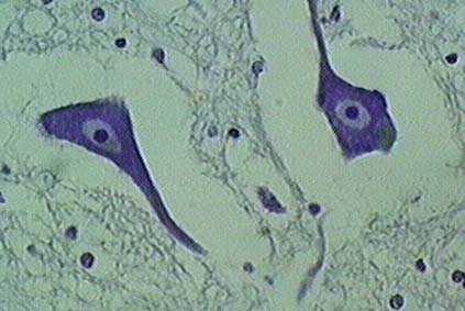 prolungamenti) Golgi spesso di estensione considerevole Sostanza di Nissl: zolle basofile che si estendono ai dendriti (ma non all assone) reticolo endoplasmatico rugoso (elevata attività di sintesi