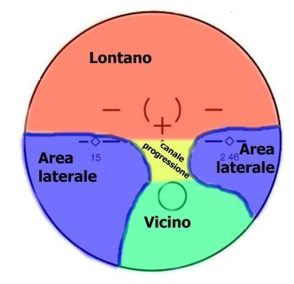 5.2.2 Lenti progressive Nelle lenti progressive la correzione ottica per lontano (in rosso) e quella per vicino (in verde) sono collegate da una zona detta canale di progressione (in giallo) nella