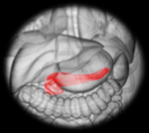 Pelvis CTV 21 Piattaforme tecnologiche per